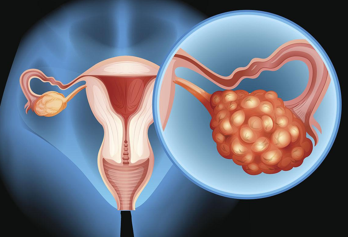 输卵管狭窄_子宫切除能怀孕么,8月统计：济源卵巢早衰患者可以做试管婴儿吗