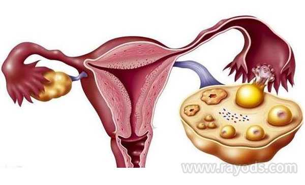 切除子宫会怀孕不_切除子宫生育吗_做试管婴儿卵巢不好影响什么吗？成功率高