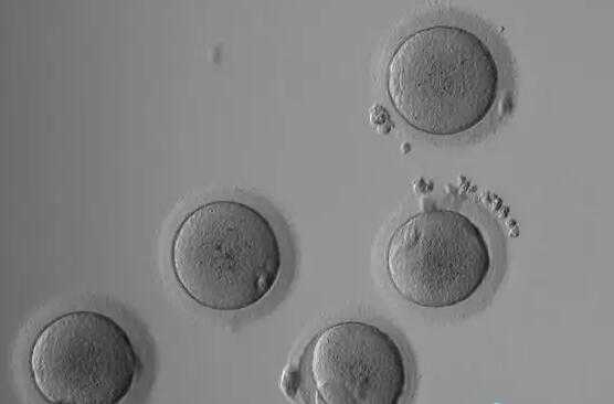 逆行射精_胎停9染色体异常_在上海一妇婴做试管成功好”孕“，亲身经历告诉你